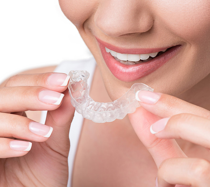 Invisalign, clear aligners in Calgary